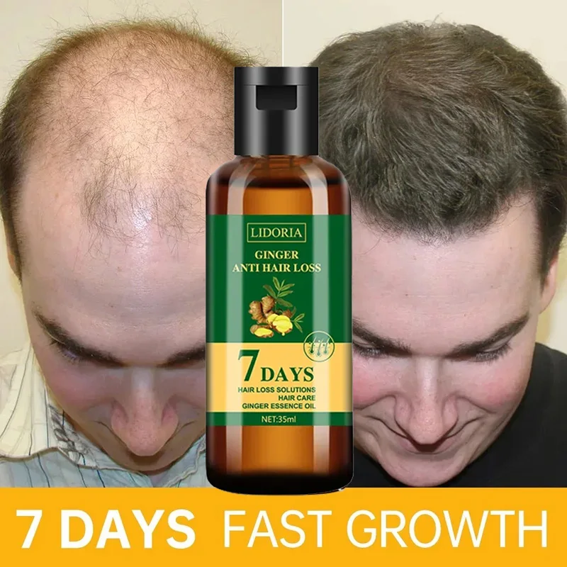 Имбирная ткань против выпадени – обзор и цена Hair Care Essential Oil Atomizing
