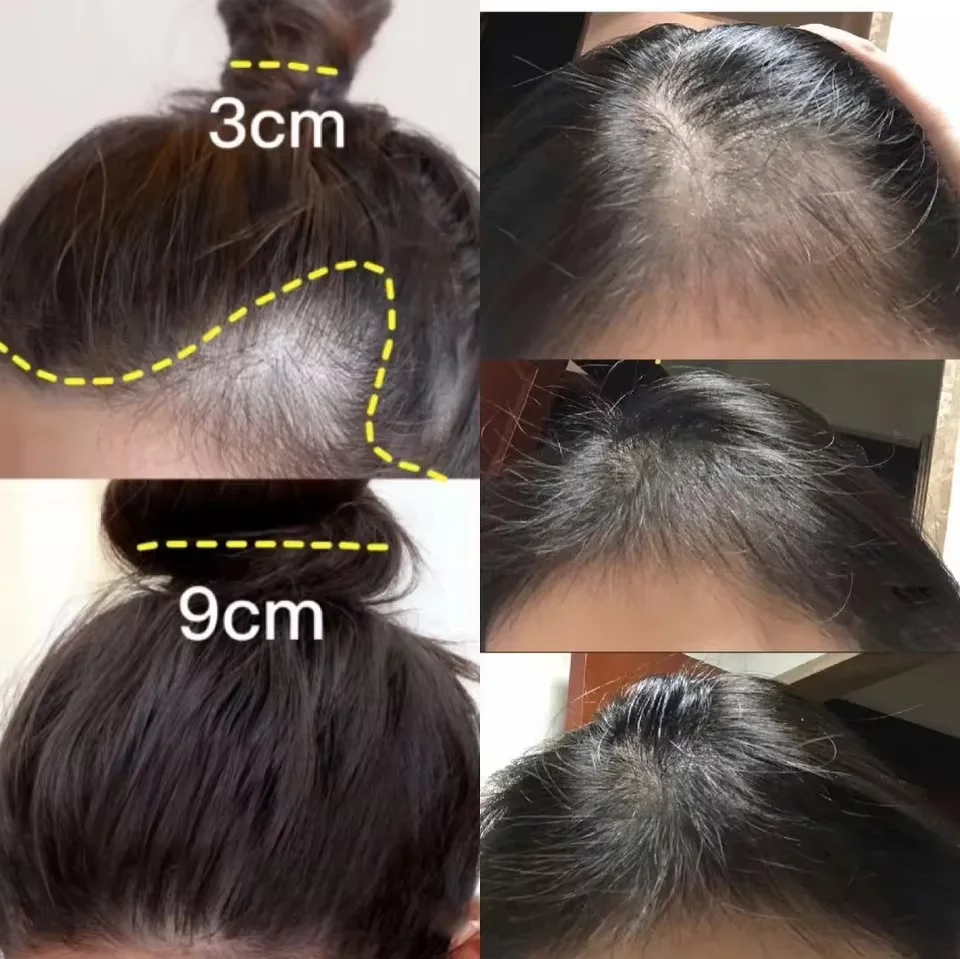 Крем для быстрого роста волос  – обзор и цена Hair Care Dupes