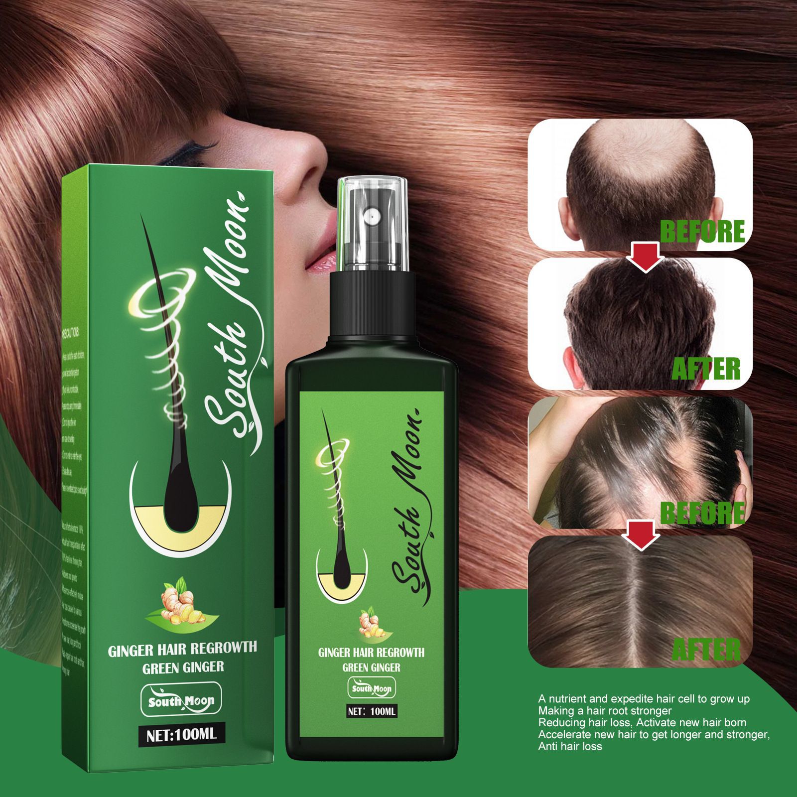Спрей для роста волос South Mo – обзор и цена Hair Care Frizzy Hair