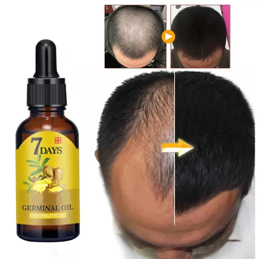Имбир для роста волос, эфирное – обзор и цена Hair Care Essential Oil Atomizing